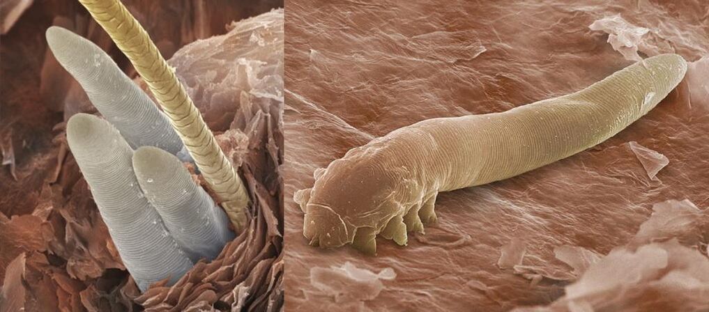 ectoparasites