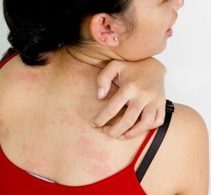 Body granulomas - symptoms of the presence of parasites