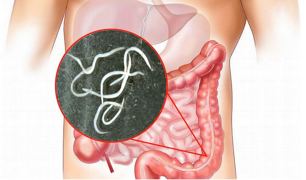 There are worms in the intestines