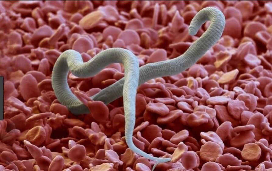 worms in human body