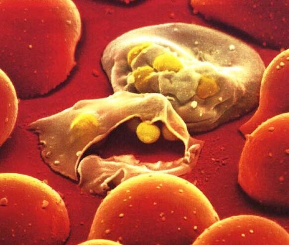The simplest parasite, malaria Plasmodium