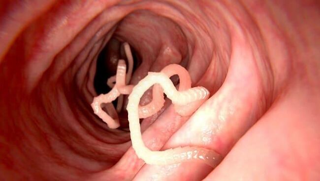 Worms living in the human intestine