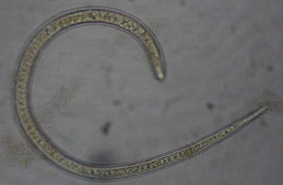 Trichinella spiralis is a protostome round parasitic worm