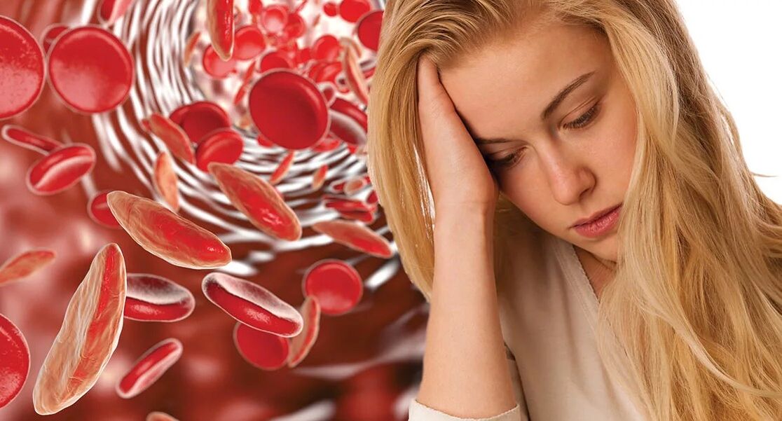 Anemia caused by parasites