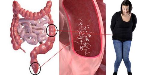 In vivo parasites