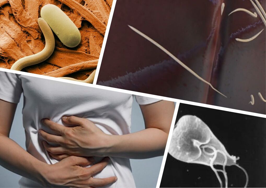 Parasites in body therapy