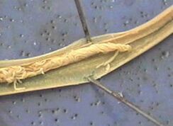 Parasite